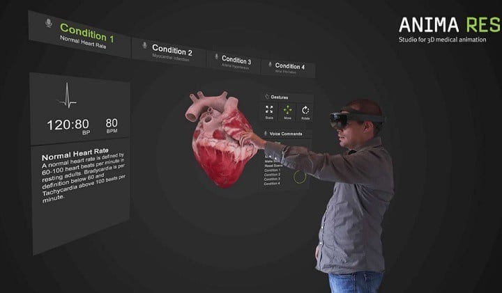 INSIGHT HEART HoloLens app