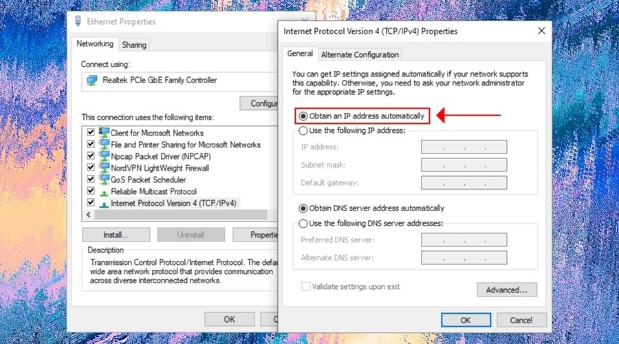 Obtain an IP address automatically in Windows